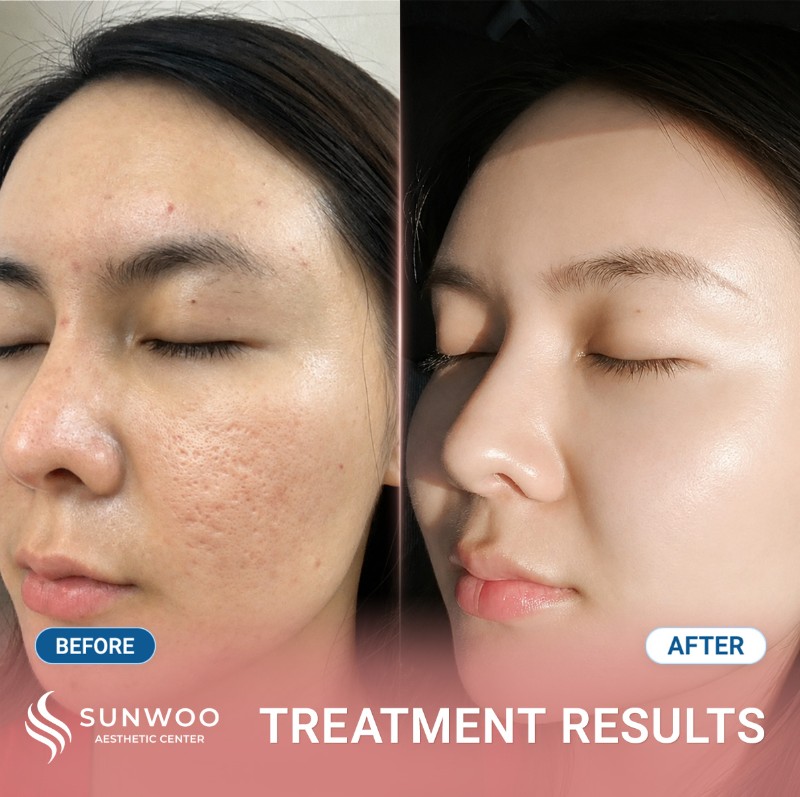 Scar before and after