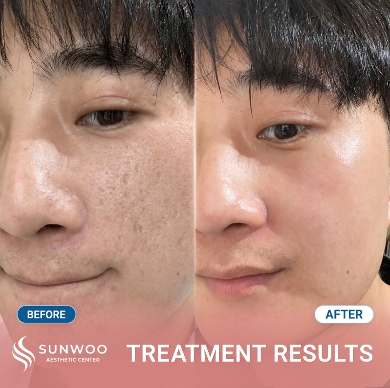Scar before and after