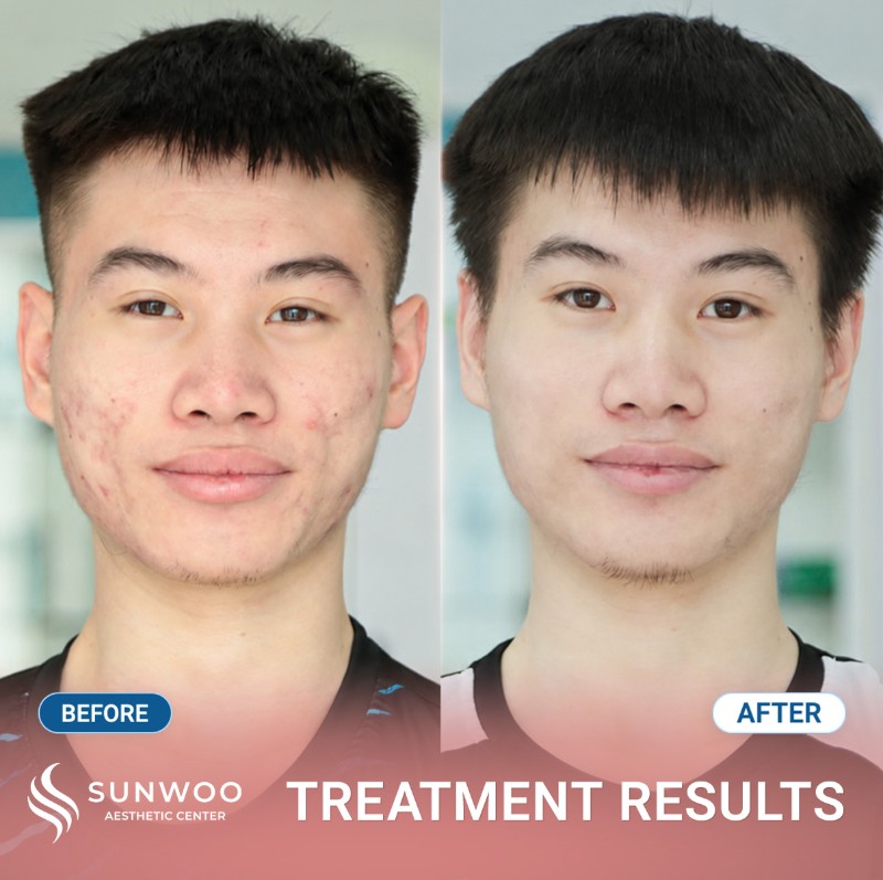Scar before and after