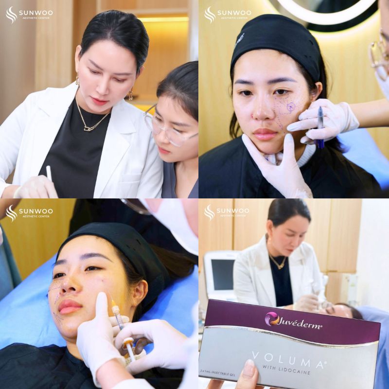 Filler procedure at Sunwoo