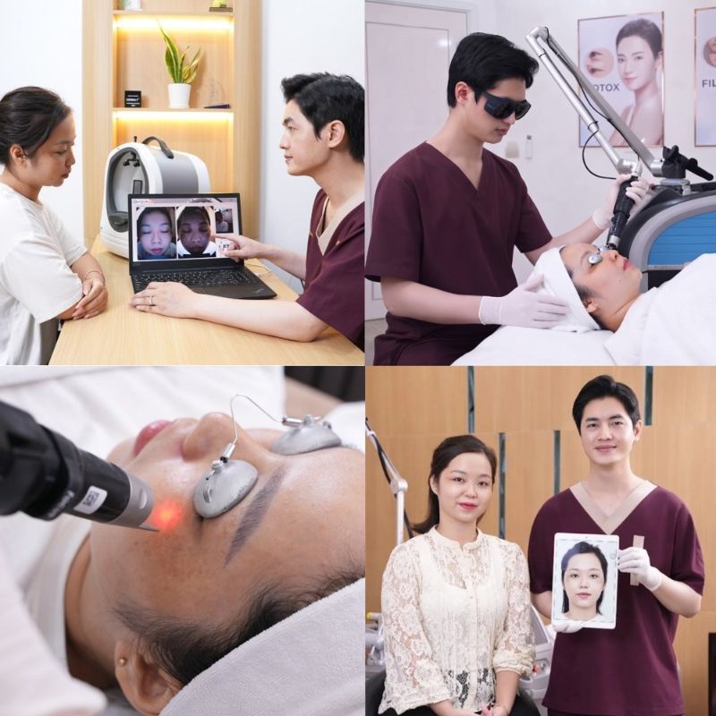 PicoSure Pro procedure at Sunwoo